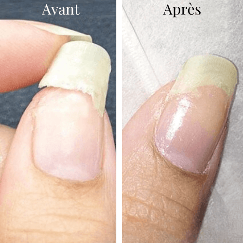 Le Gel RépareOngles™